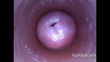 Kamera Langsung: Endoskop Menyelusuri Dalam Vagina